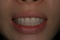 ［リスク・副作用］