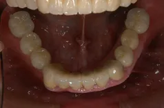 ［リスク・副作用］