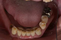 ［リスク・副作用］