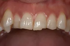 ［リスク・副作用］