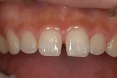 ［リスク・副作用］