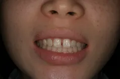 ［リスク・副作用］