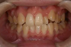 ［リスク・副作用］