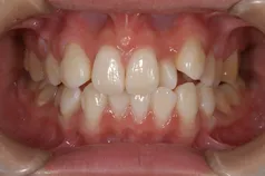 ［リスク・副作用］