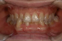 ［リスク・副作用］