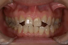 ［リスク・副作用］