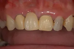 ［リスク・副作用］