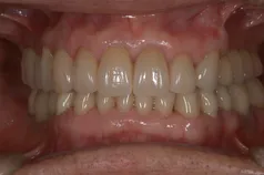 ［リスク・副作用］