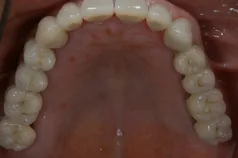 ［リスク・副作用］