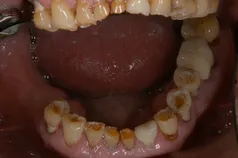 ［リスク・副作用］