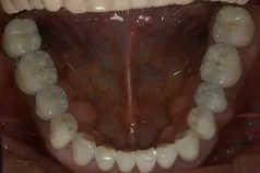 ［リスク・副作用］