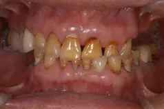 ［リスク・副作用］